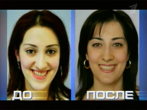 инулин с мурайю инструкция