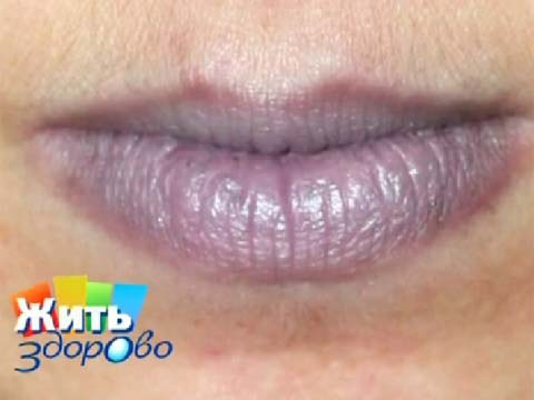 От чего синеют губы у беременных От чего синеют губы у беременных