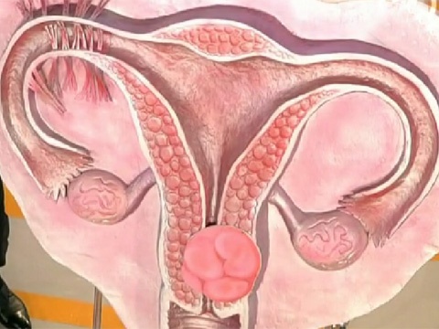 Что такое папилломавирусная инфекция у женщин в гинекологии